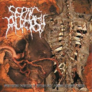 Septic Autopsy - Spontaneous Emanation Of Rotting Smell Through Necropsy Process (2016)